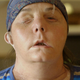 Image for article titled The story behind this woman's face transplant is simply incredible